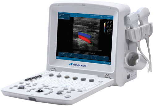 Ultrasound System DUS – 5000