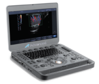 Ultrasound System DUS - 5000Plus