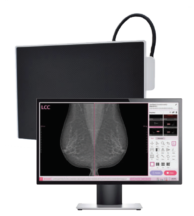 Innovative Digital Mammography Upgrade Solution